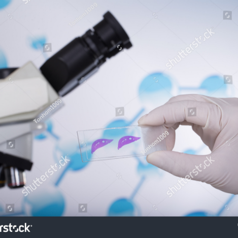 tissue biopsy