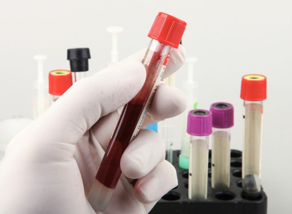 blood test during healths screening
