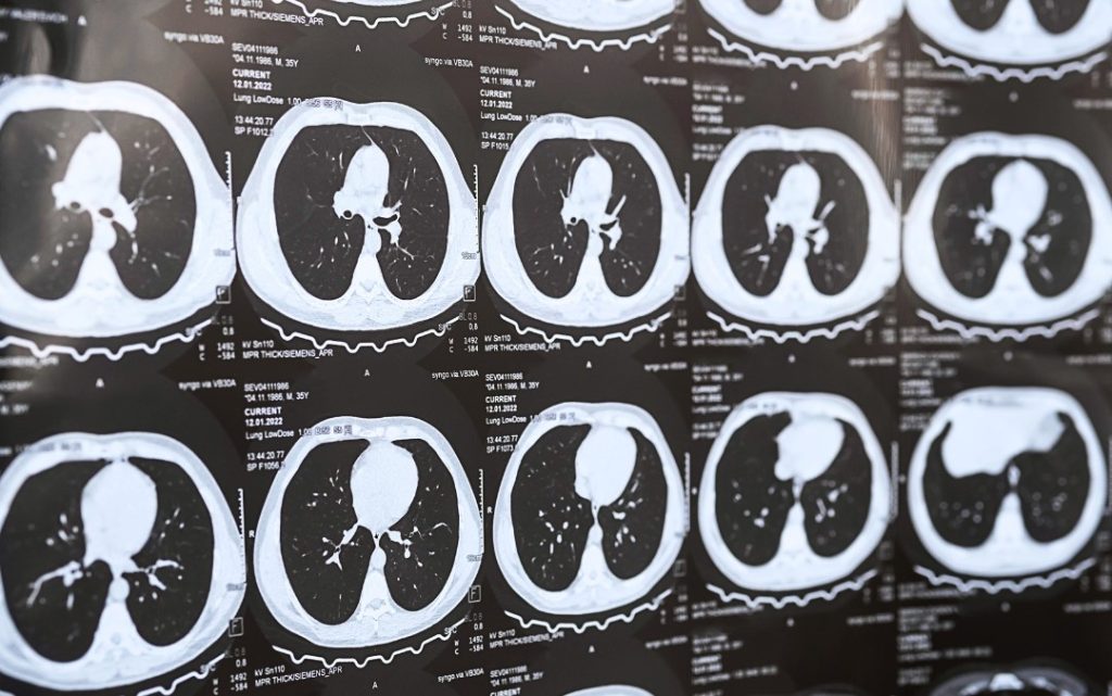 ct cardiac scan
